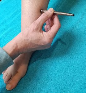 Acupunctuur Magneetmassage