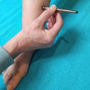 Acupunctuur Magneetmassage