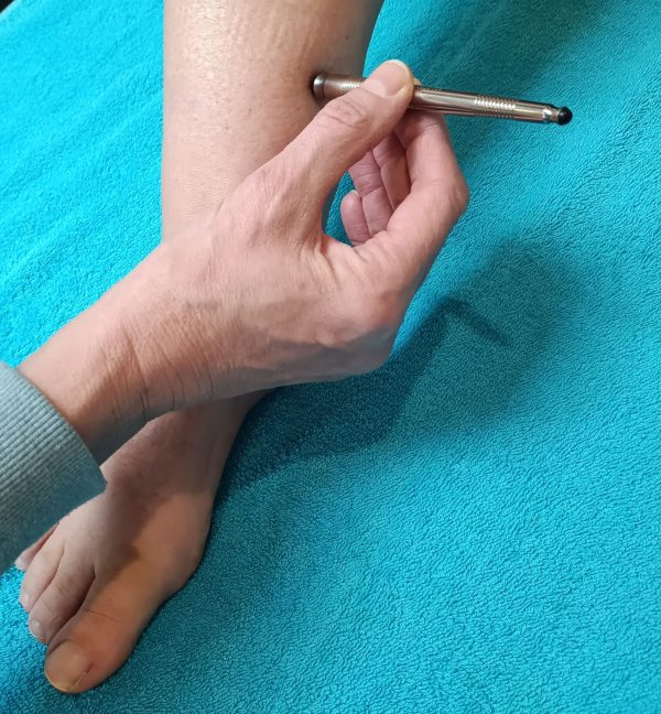 Acupunctuur Magneetmassage